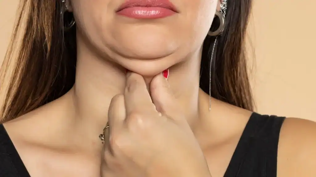 An image of a woman with double chin, sad, worried : Non Surgical Double Chin Removal Treatment in Sunningdale, UK