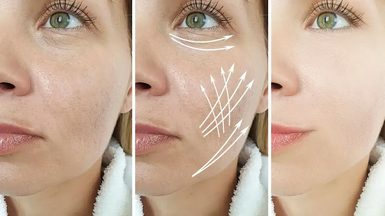 Can One Treatment Really Tackle More Than One Skin Concern Sunningdale?