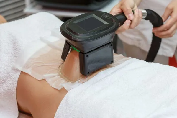 Image of person having fat freezing treatment to help weight gain Sunningdale