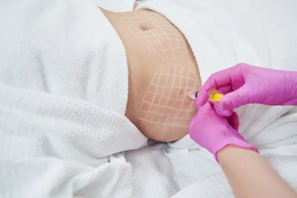 image of fat dissolving injections on love handles to help combat weight gain Sunningdale