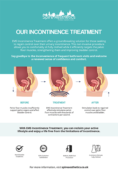 image to show how EMS treatment works for female urinary incontinence Sunningdale