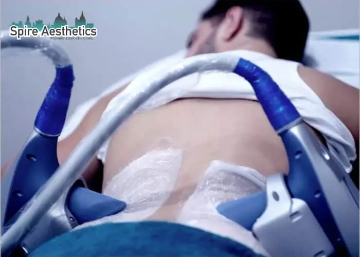 Man having fat freezing treatment done on love handles before a competitions Sunningdale to create a sculpted look.