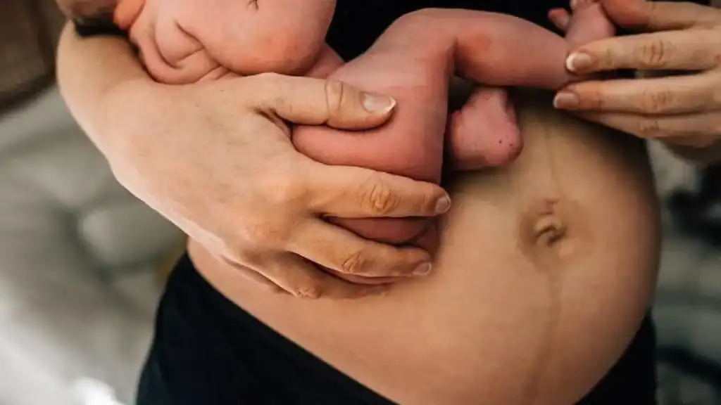 Why Is My Stomach Still Big After Pregnancy Sunningdale?